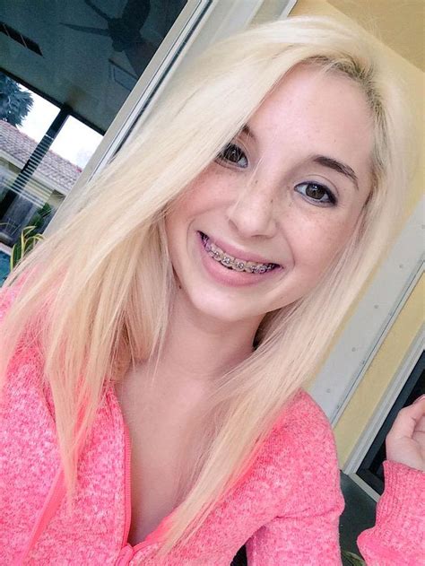 pornstars with braces|Porn Stars With Braces Porn Videos 